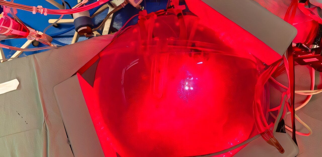 Chest 'digital twin' predicts light paths to help plan personalized pneumonia treatment