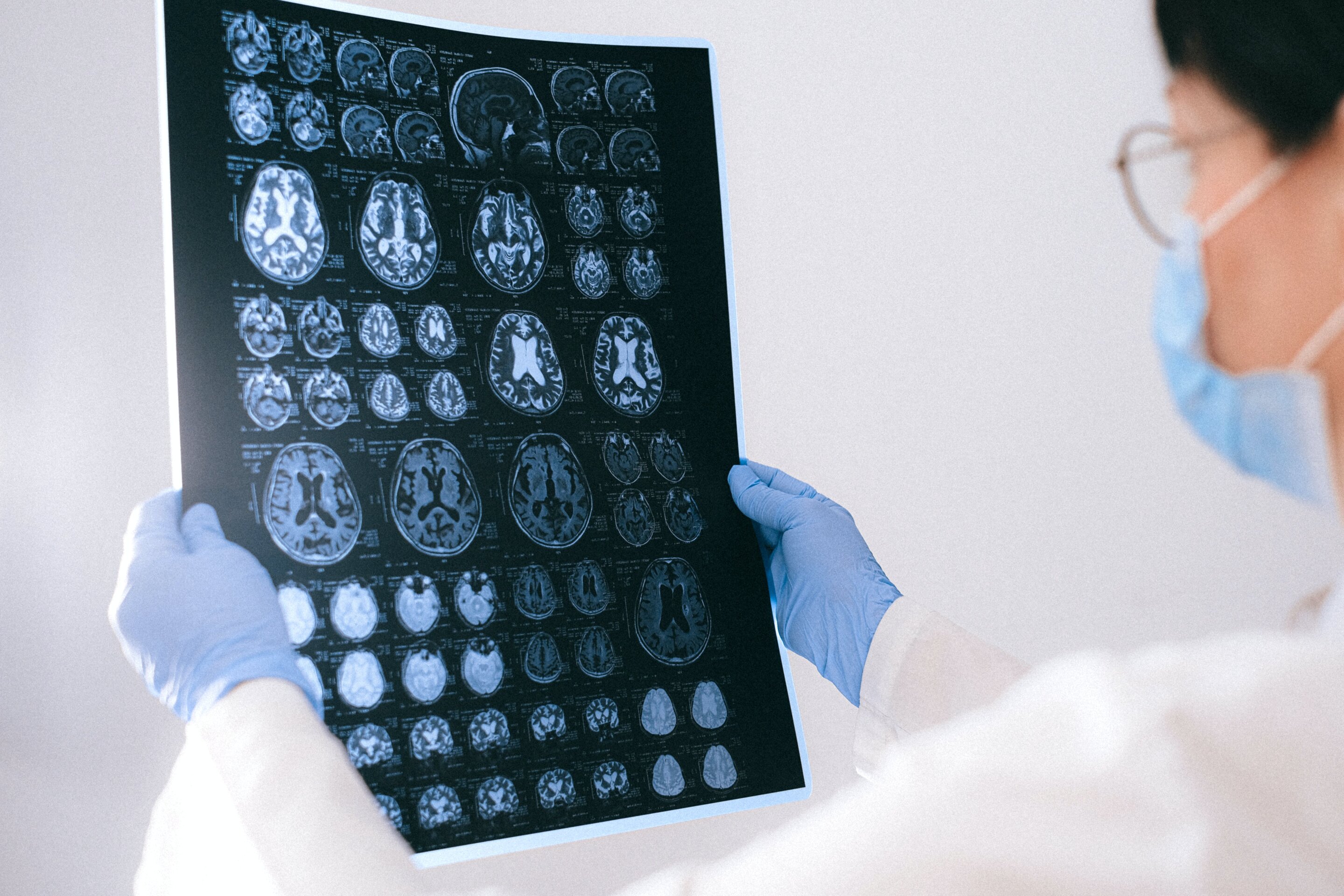 Spinal fluid DNA testing may clarify brain tumor diagnoses when MRI leaves questions