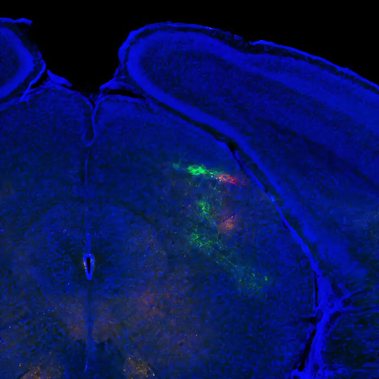 Why every bump in the night feels different: The neuroscience of sensory perception