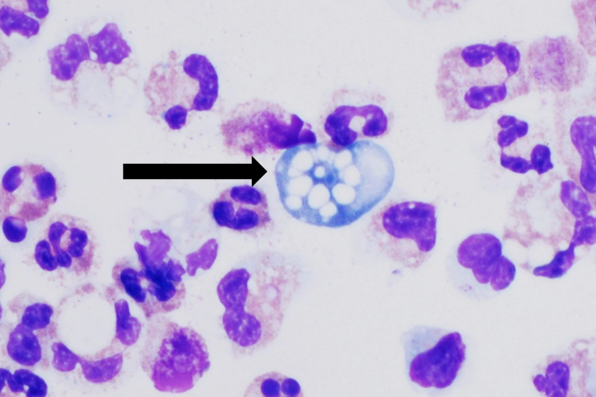 The Brain-Eating Amoeba Kills 97% of Its Victims. Scientists May Have Found a Way to Stop It in Hours