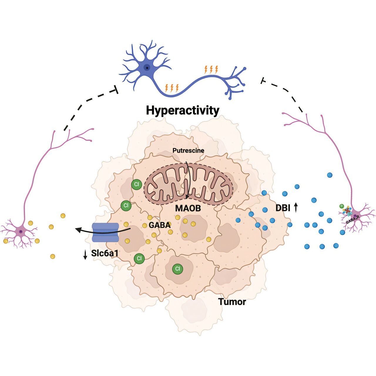 Glioblastoma's secret weapon: Silencing the brain's off switch