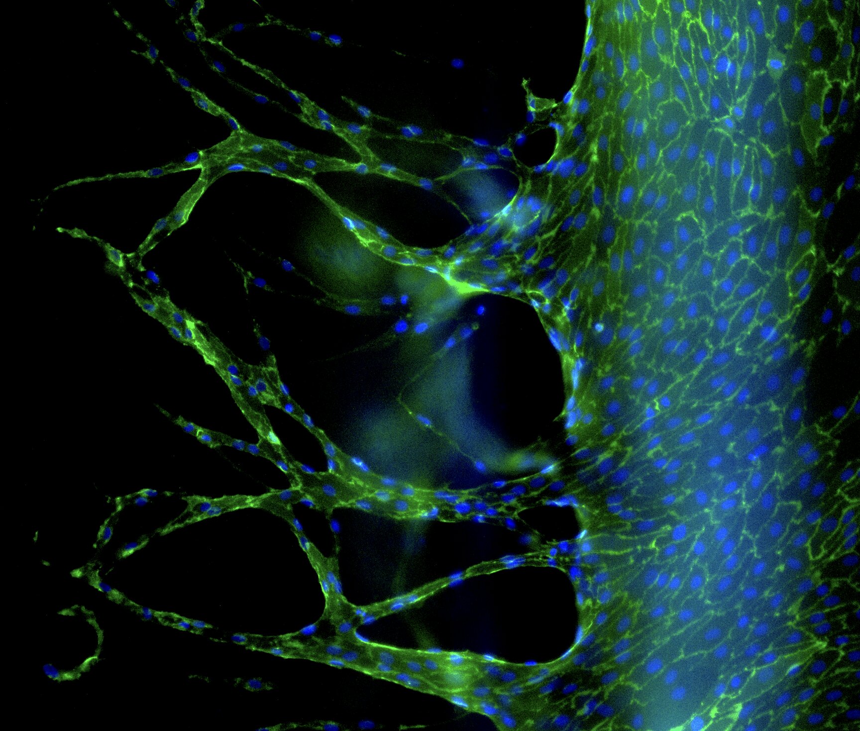 How our blood vessels age from within