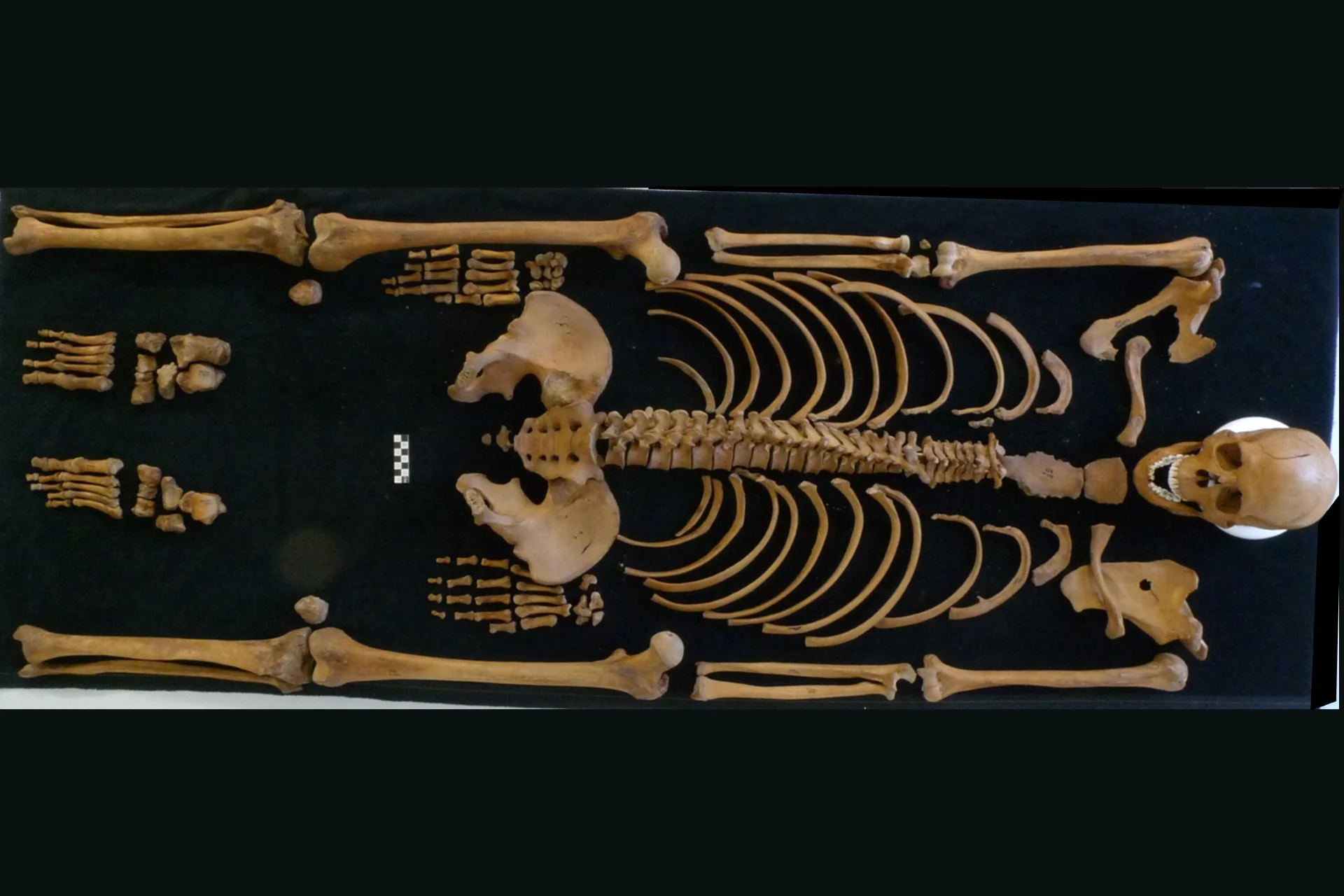 Archaeologists Thought This Roman Soldier Was Killed in a Tax Revolt. The Truth May Be Much Worse