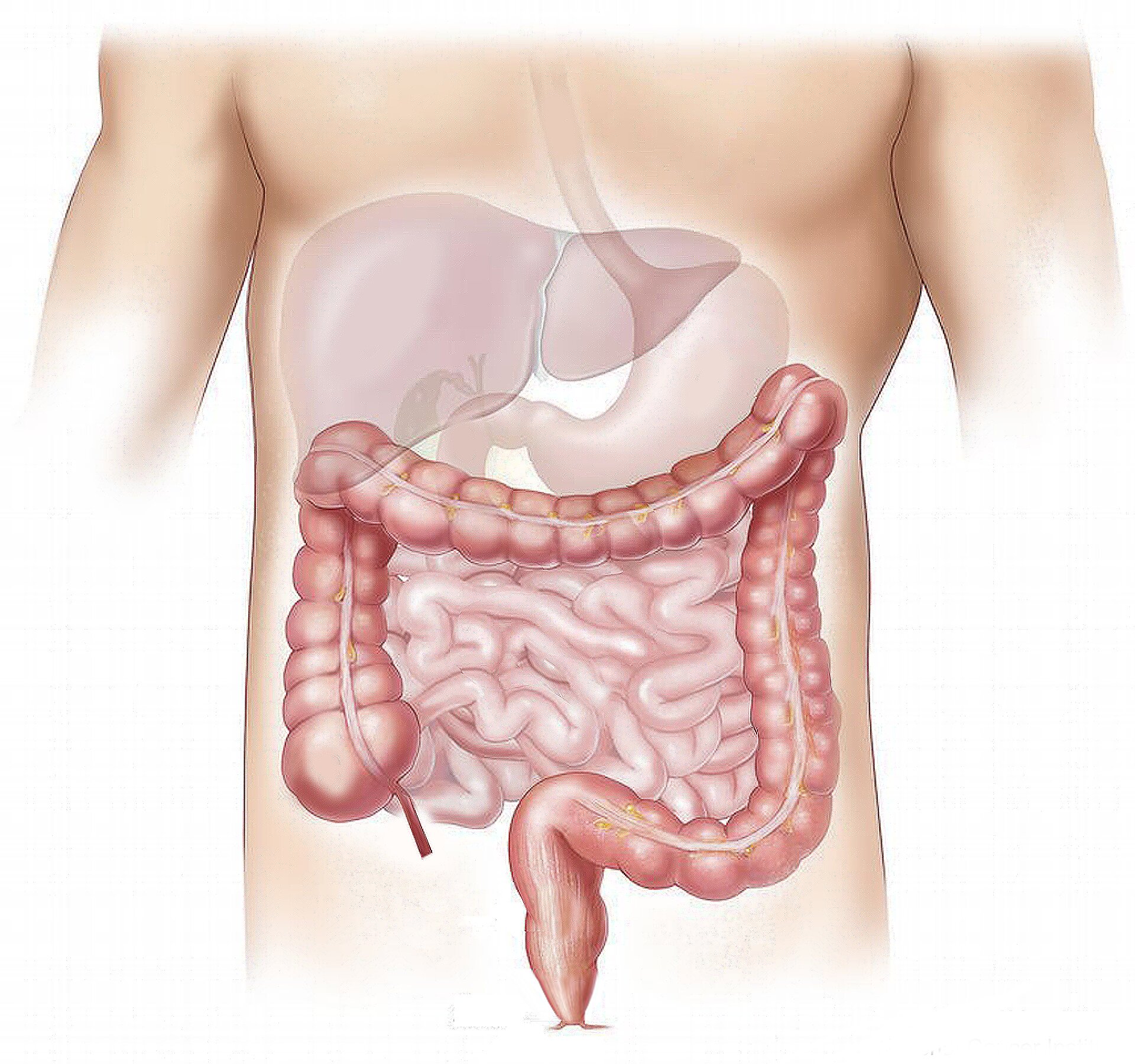 Improve IBD bowel checks for early cancer detection