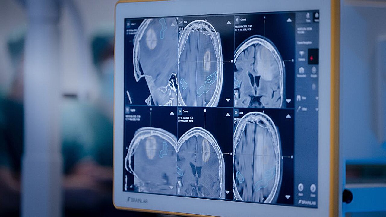 Researchers develop privacy-friendly, secure and sustainable AI techniques for medical imaging