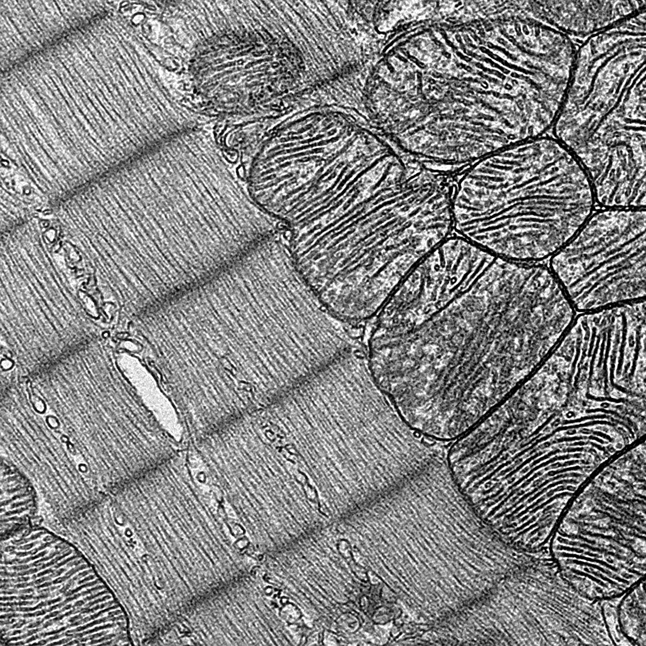 How the heart's unusual carbohydrate metabolism helps it stay strong