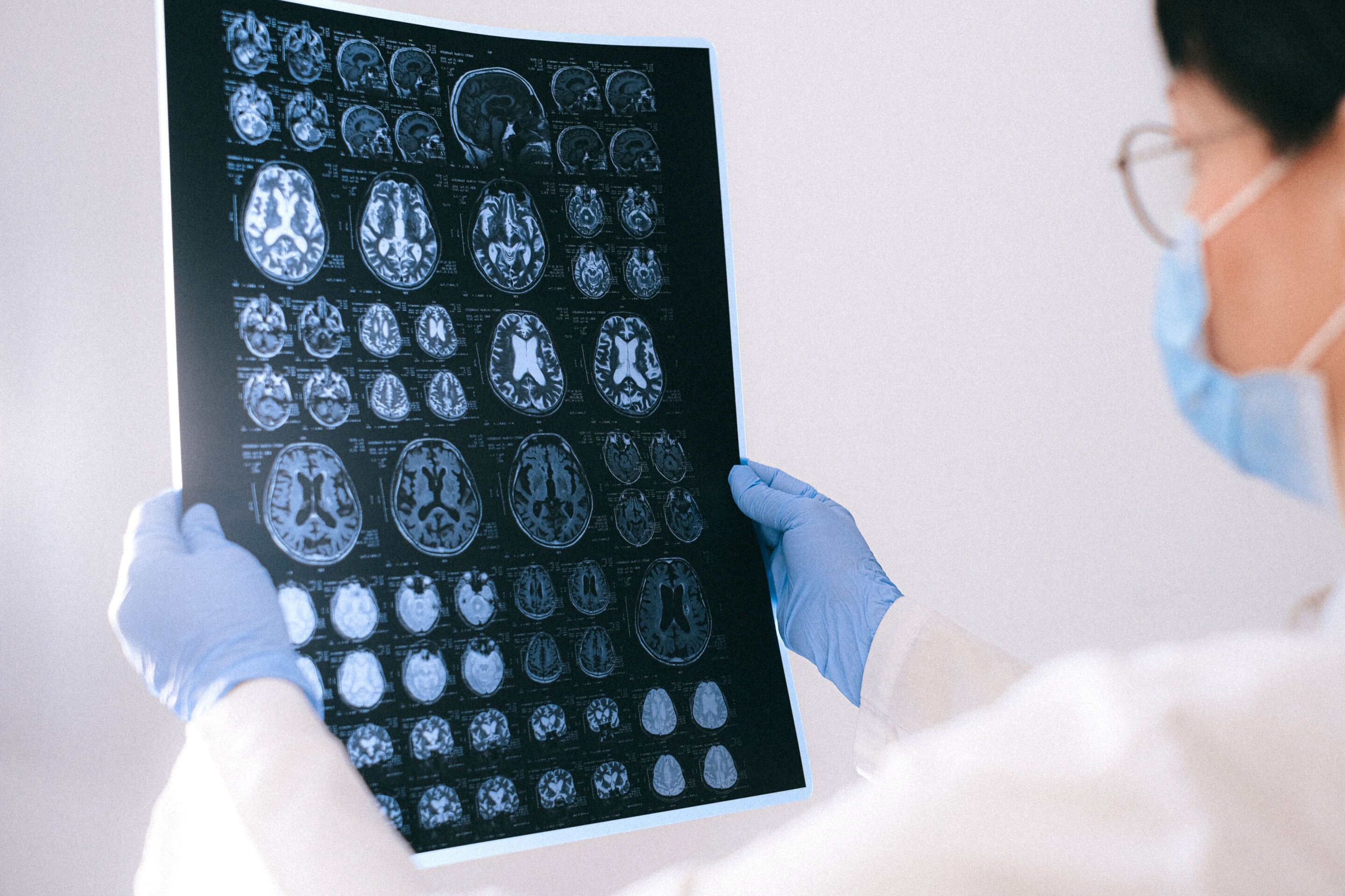 Brain scans challenge link between prefrontal activity and ability to regulate emotions