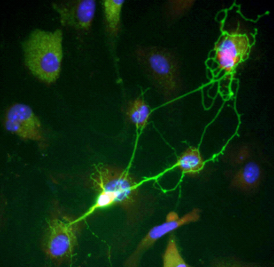 Abnormal neurons are surprisingly common in the developing brain