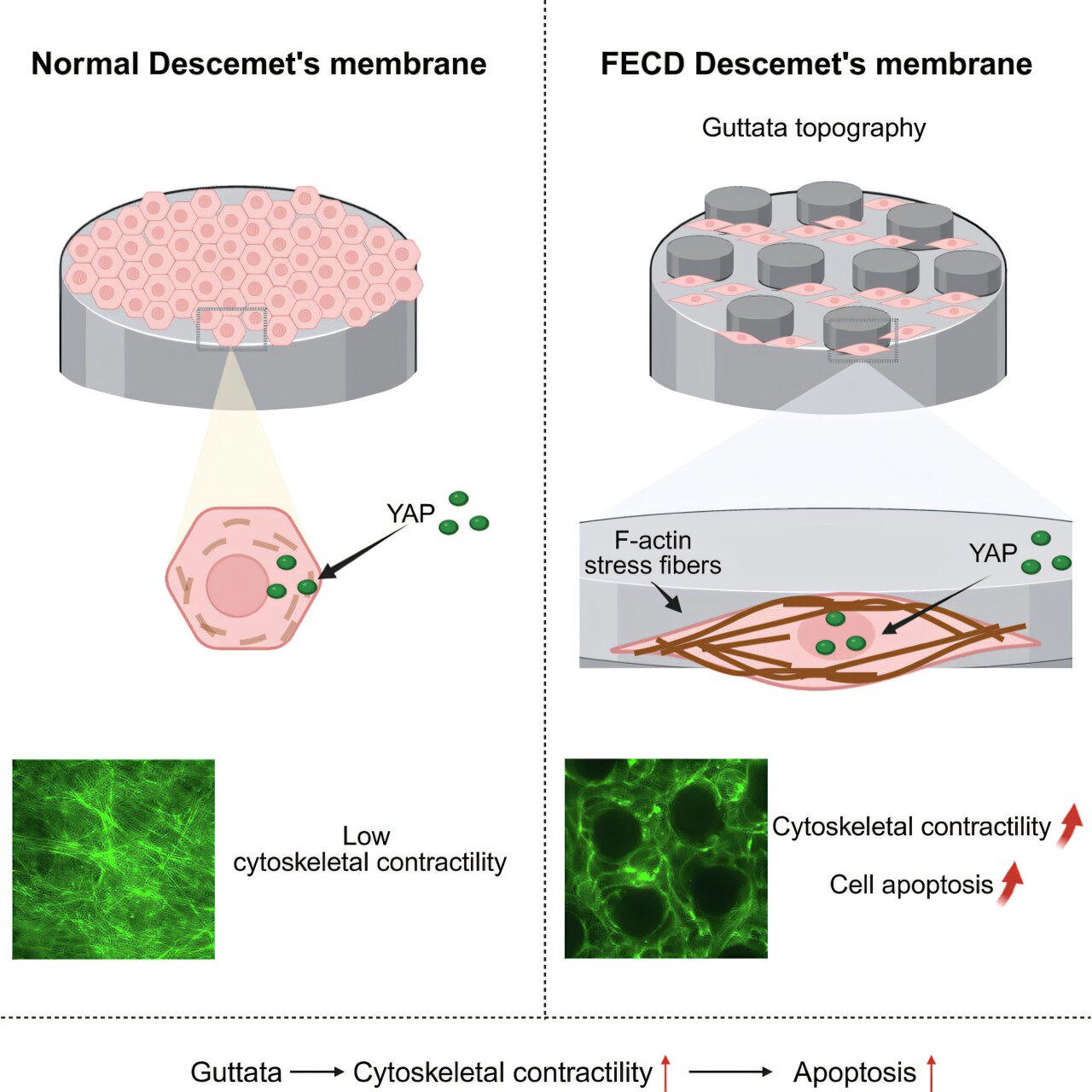 Tiny corneal bumps reveal potential path toward treating severe vision loss