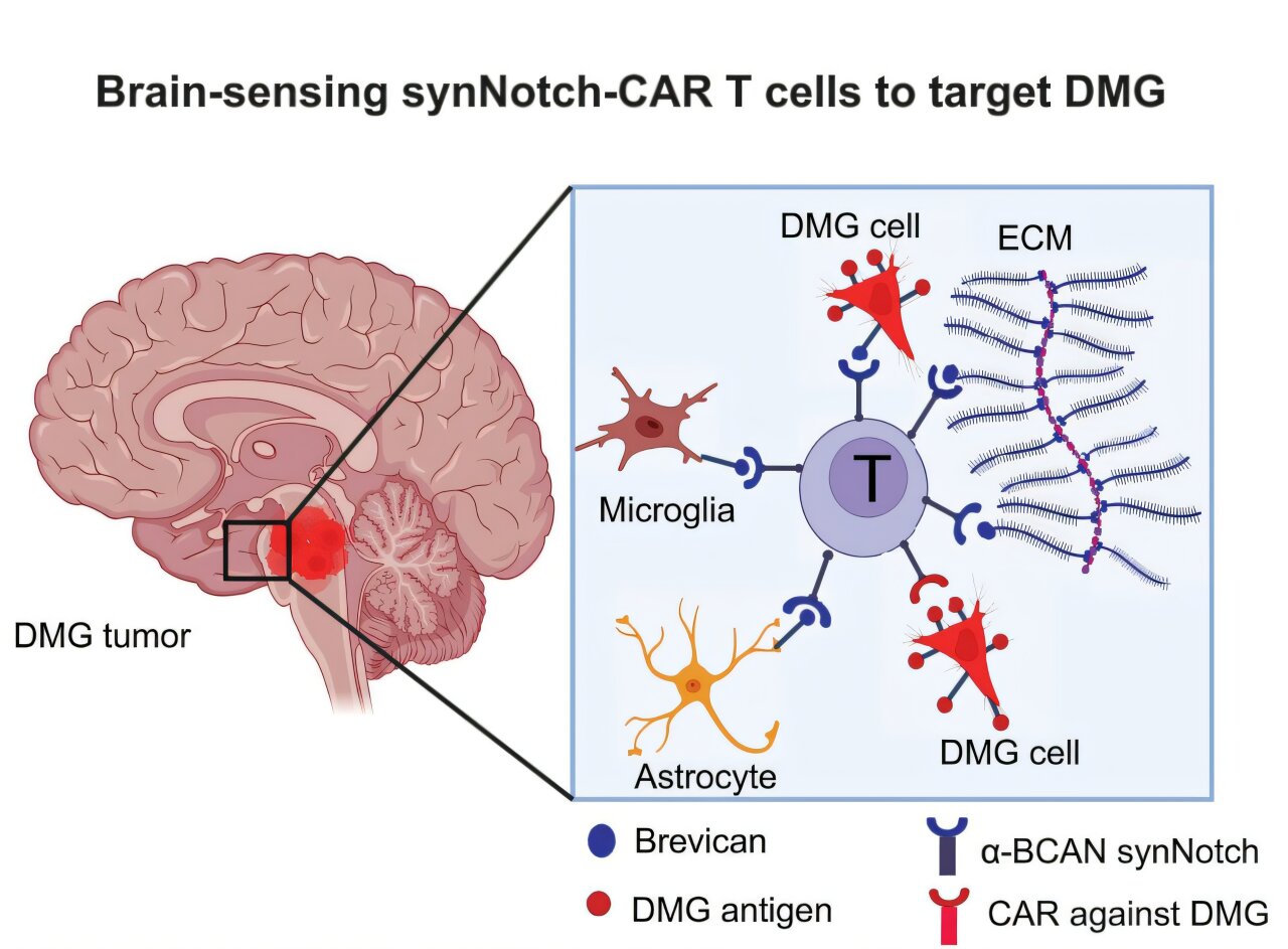 Smarter CAR-T cells could beat a deadly pediatric brain cancer