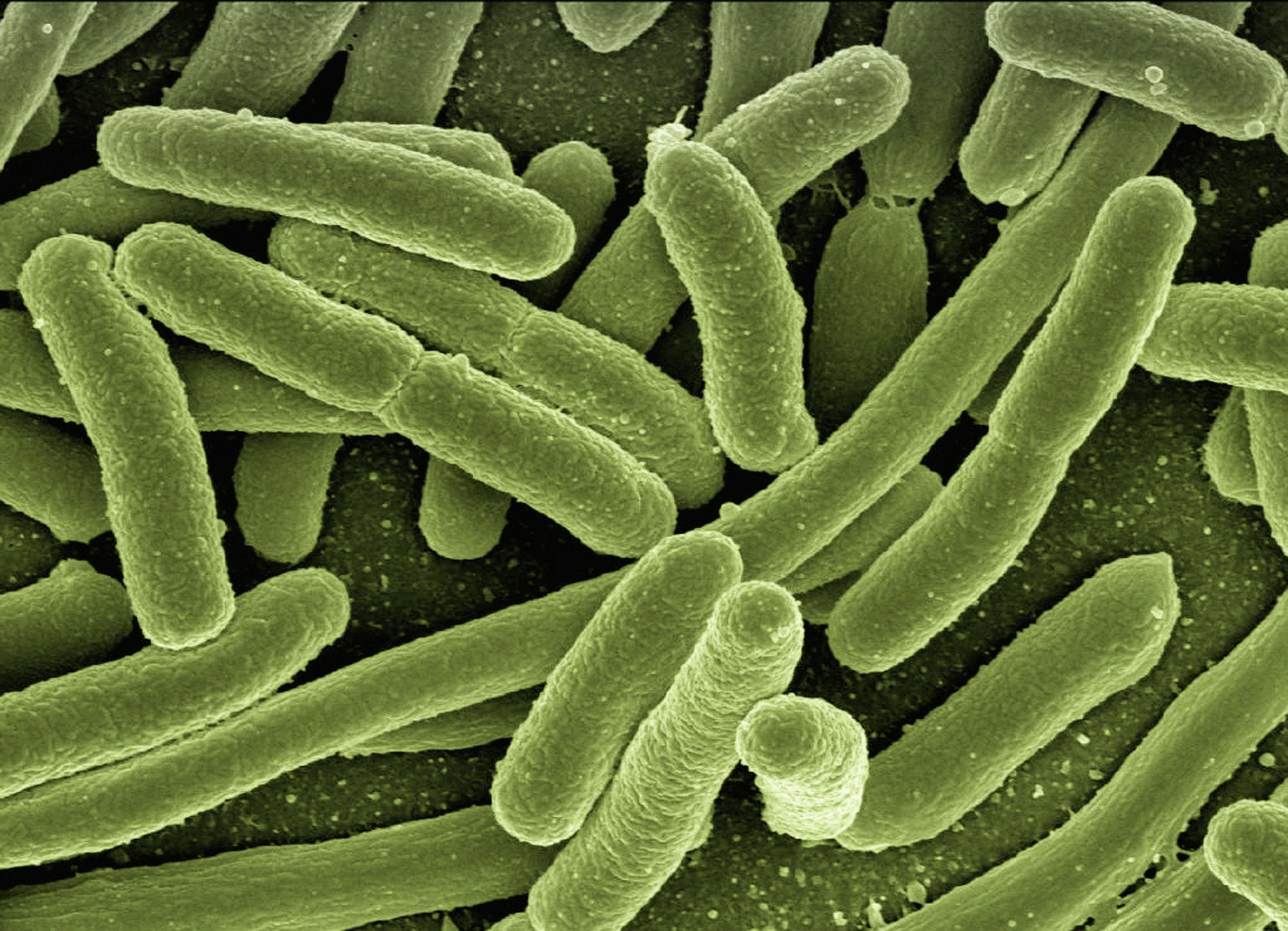 CDC names the 4 most dangerous superbugs in the US