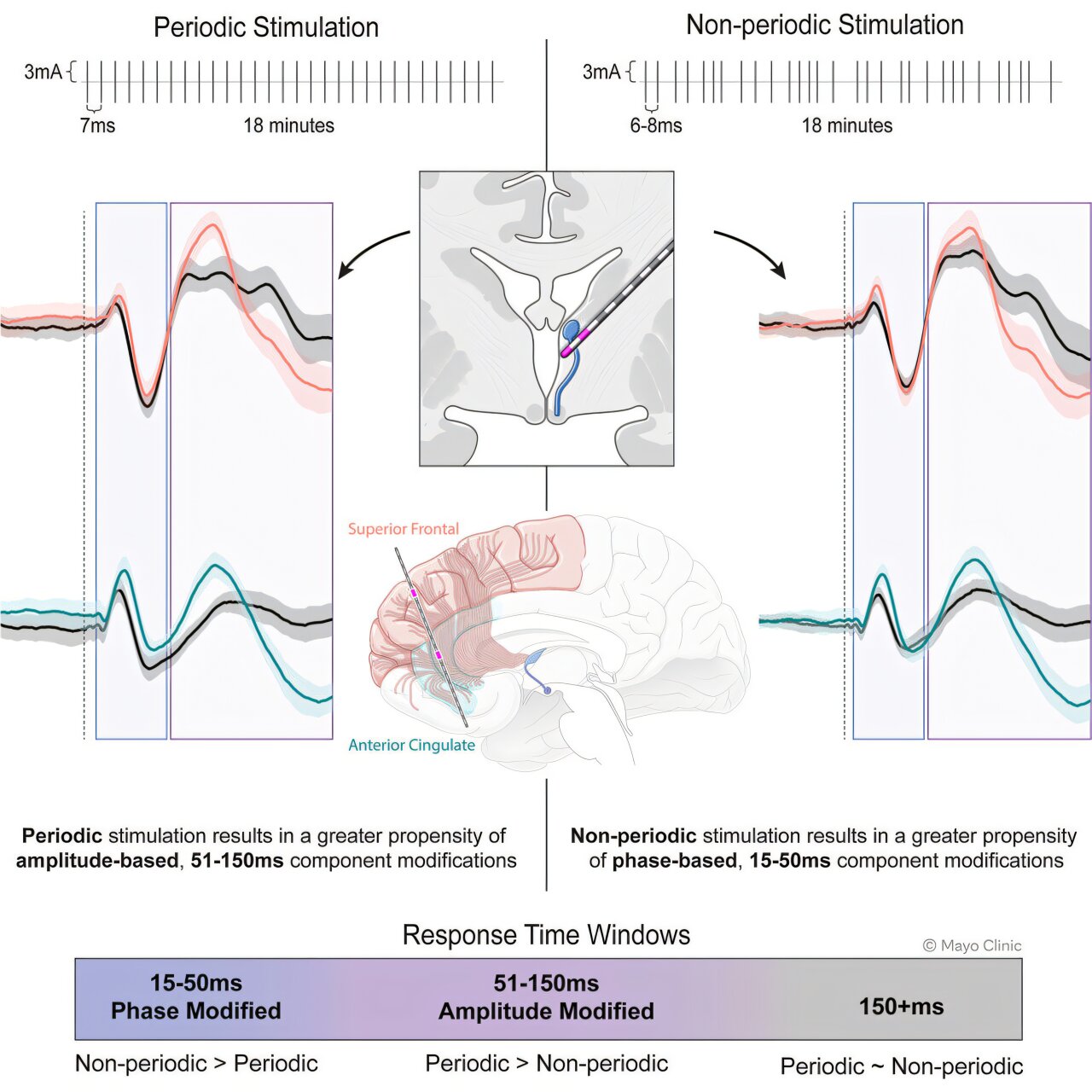 Deep brain stimulation in patients with epilepsy produces measurable response within minutes, study finds