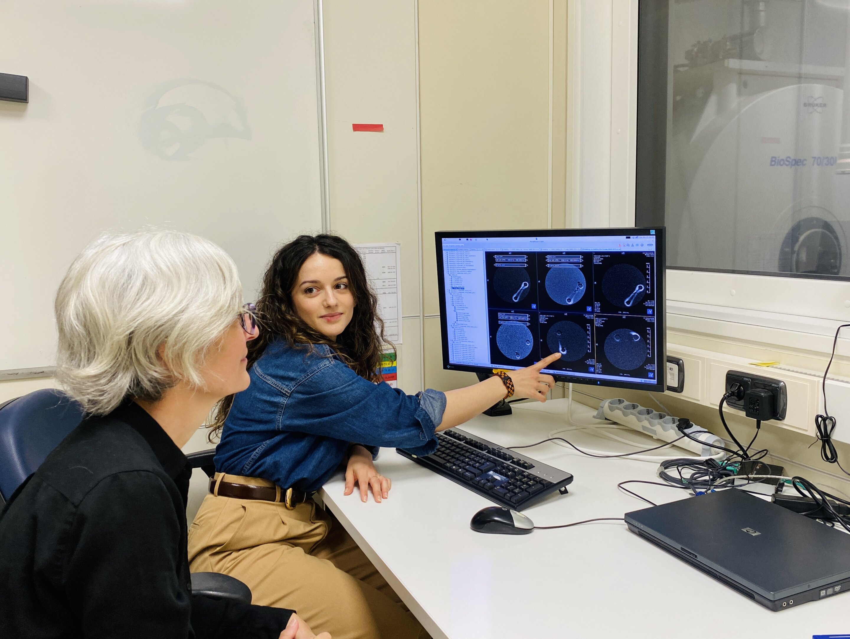 Iron-based MRI agent detects and slows heart scarring in lab-grown human tissue