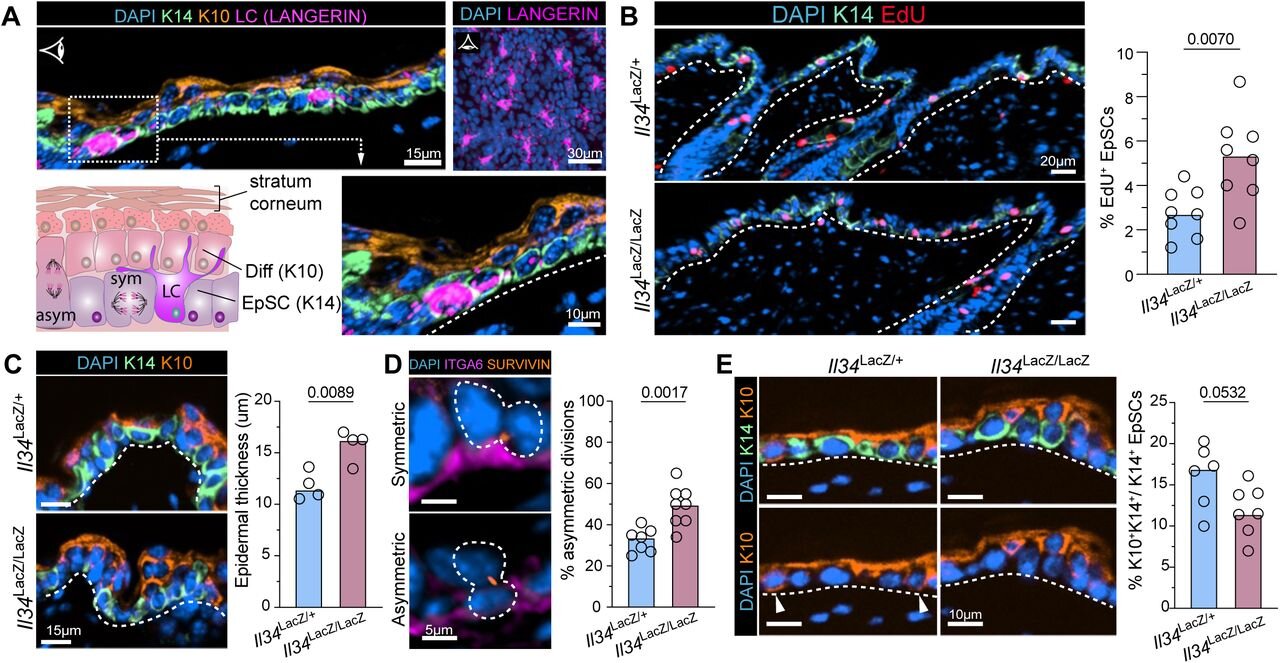 Specialized immune cells may help skin nimbly respond to changing environmental conditions