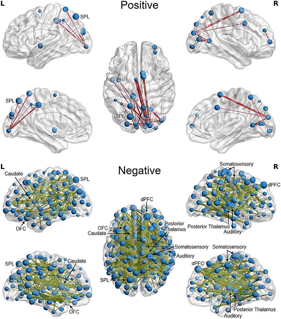 Older brains cope better with lack of sleep, says study