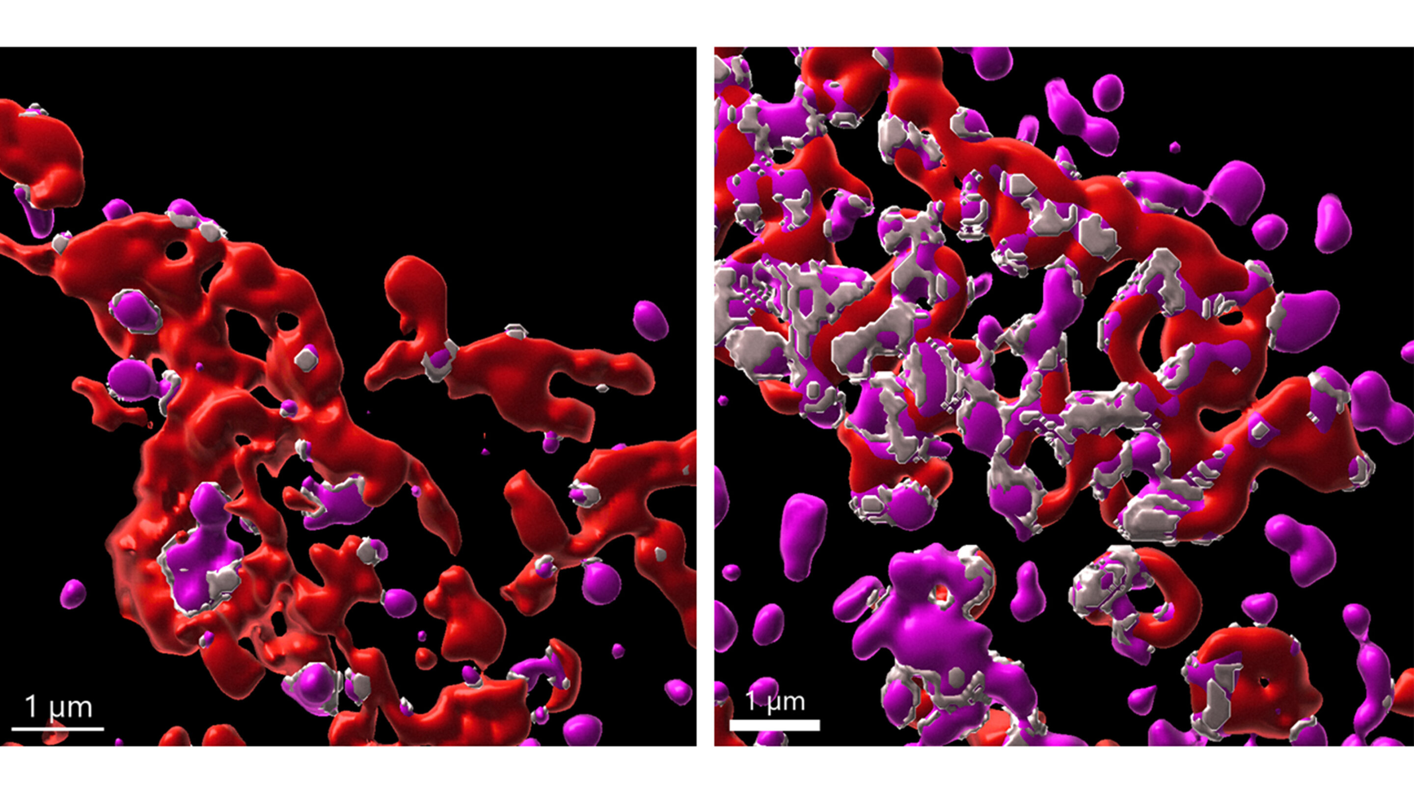 Immune system protein is a cancer killer on its own, new study shows