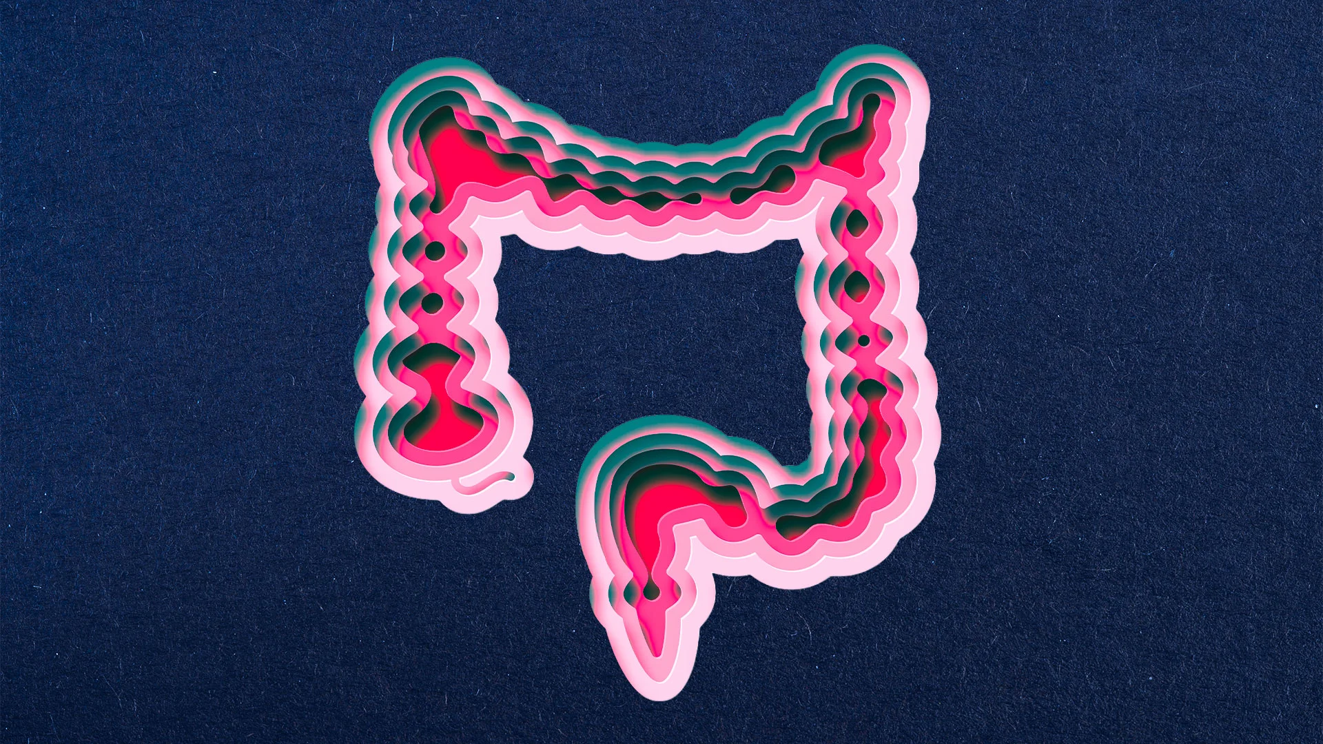 Colon cancer rates are rising for the first time in 20 years. Here’s who’s most at risk