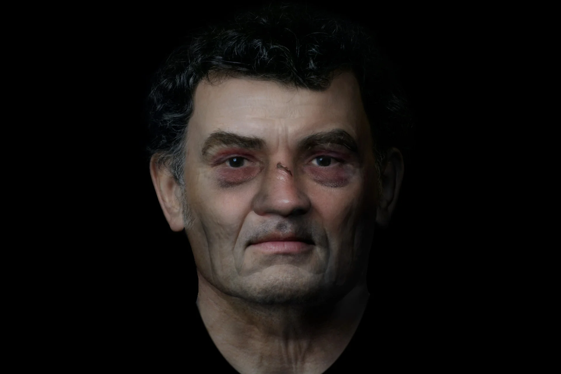 A Broken Nose, a Damaged Arm, and a Gruesome Grave. This Man From Roman Scotland Now Has a Face