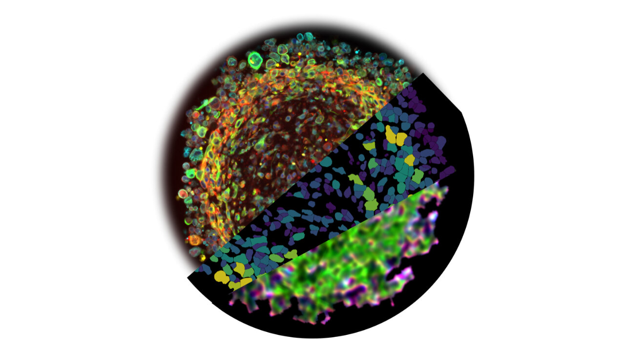 Space-grown glioblastoma organoids could help advance brain cancer treatments