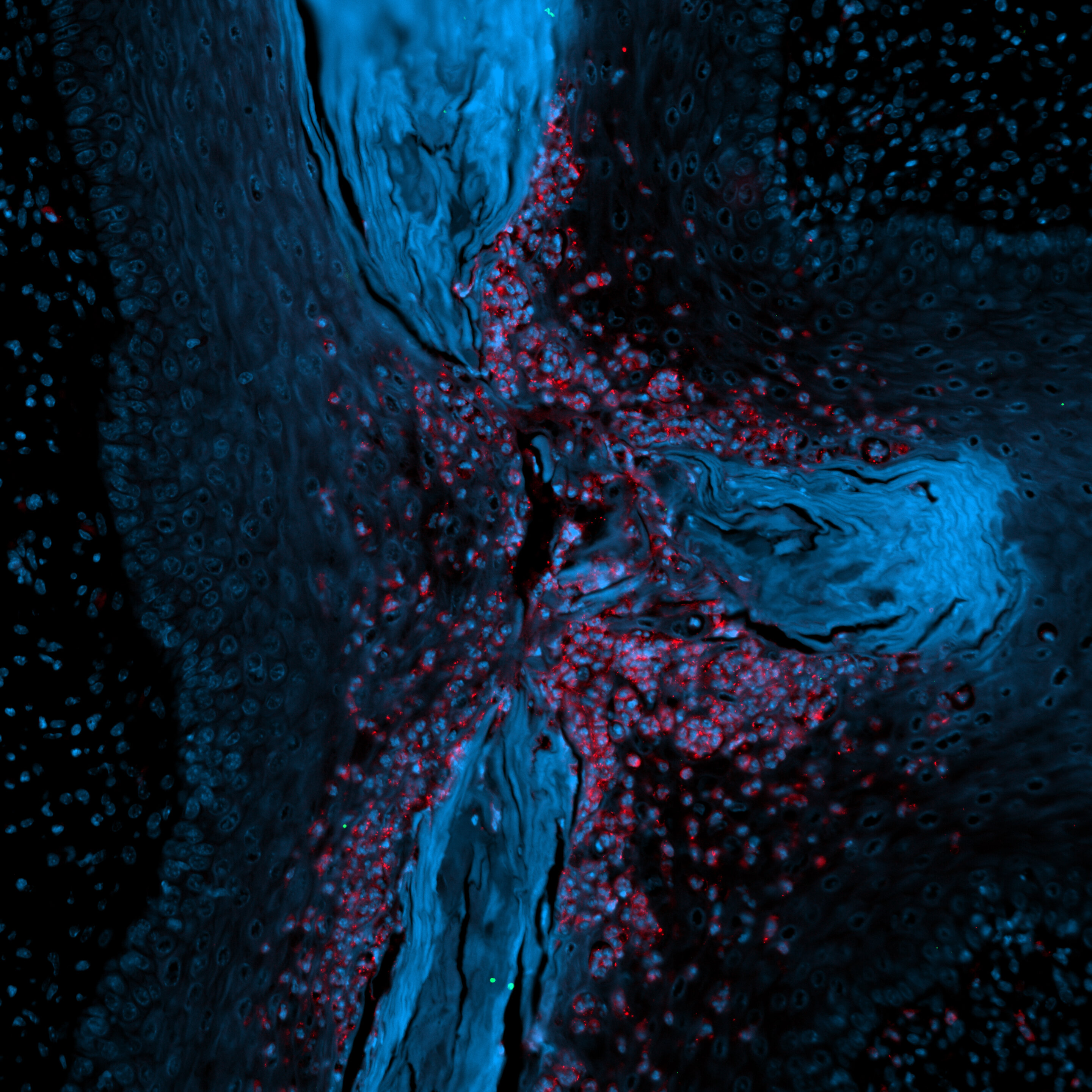 How one of the body's own proteins drives the vicious cycle of inflammation in vaginal yeast infections